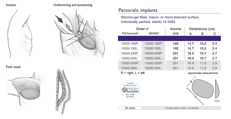 Kích cỡ Mô cấy ngực nam nhân tạo-Polytech Pectoral Implant