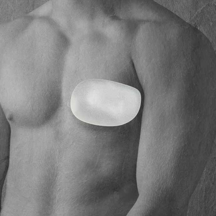 Mô cấy ngực nam nhân tạo-Polytech Pectoral Implant