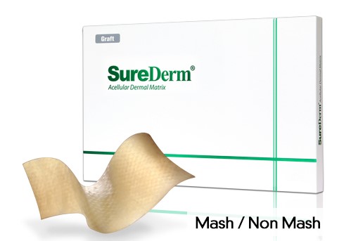 SureDerm thường được dùng để bọc sụn đầu mũi (thay thế sụn vành tai)