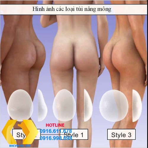 Những điều cần biết về nâng mông đẹp Hàn Quốc bằng phương pháp nội soi