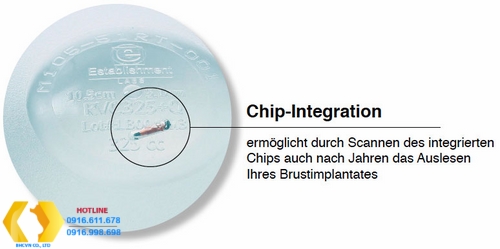 Tìm hiểu về túi Nâng ngực Motiva nano chip