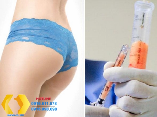 Ưu nhược điểm các phương pháp phẫu thuật giúp mông đẹp Hàn Quốc