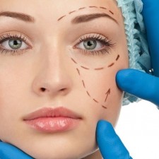 Căng da mặt cần không phẫu thuật